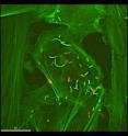 Listeria monocytogenes cardiac-invasive strain replicating and moving within infected heart cells. The bacteria (red rods) invade heart cells, multiply, and begin to move through the cell by rearranging cell structural proteins (green) that initially coat the bacteria (green and red rods) and then form long comet tails located directly behind moving bacteria.