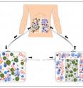 Schematic shows how fluids containing ovarian cancer cells could be removed from the body, treated with magnetic nanoparticles to remove the cells, then returned to the body.