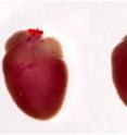 Hearts from a wild type control mouse (left) and from a DOT1L-deleted mouse displaying dilated cardiomyopathy (right) . In the absence of DOT1L hearts become severely enlarged, compromising heart function.