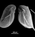 This is a juvenile Daphnia with and without defensive neckteeth.