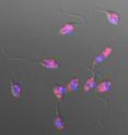 Viral infections appear red in this photo of the parasite Leishmania; the parasites’ nuclei are blue. New evidence published in <i>Science</i> this week suggests that these infections may help Leishmania cause more harm when it infects animal and human hosts.