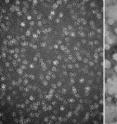 Electron microscopy images demonstrate how glycogen molecules (left) become structurally abnormal (right) when excessive levels of phosphate are attached due to a mutation in the lafora gene.