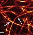 Bended actin/fascin bundles indicate stress, incorporated when the network formed. As relaxations over time gradually diminish these tensions, their contribution to the network's elasticity disappears. (length of the bar: 2 µm)