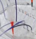 Images of the microfluidic device developed at Georgia Tech to help researchers predict T cell age and quality in order to improve a type of cancer therapy called adoptive transfer of T cells.