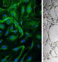 Human endothelial progenitor cells grown in the lab (left) and forming capillary tube like structures (right).