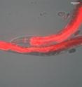 This image shows <I>C. elegans</I> expressing flourescently labelled progranulin in the head and intestines.