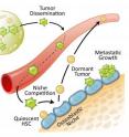 This is a drawing of prostate cancer cells in the bone marrow niche.