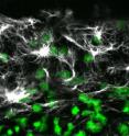 This confocal image shows high levels of the protein vimentin (white) at the edge zone of a quail embryo. Cell nuclei are labeled green.