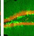 More newborn neurons (light green blotches near orange areas) are visible in part of the hippocampus of an adult mouse in which neurogenesis was genetically enhanced (right) than in a control mouse (left) .