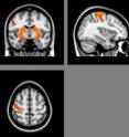 These figures correlate fMRI activation with how finger sequences are grouped into integrated clusters. This leads to the the production of fluid low-cost movements.