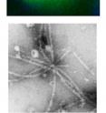 The top image is of yeast expressing FUS. Note the presence of FUS clumps in the cytoplasm (green foci) and the position of the nucleus (blue). The bottom image is an electron microscopy image of clumps formed by pure FUS in the test tube.