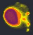 This is a photo of the genetic material in the large cell nucleus and in the small mitochondria.