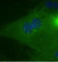 In liver cells, so-called class II HDACs (shown in green) are usually sequestered in the nucleus.