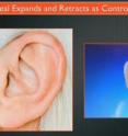 This is the Asius Ambrose Diaphonic Ear Lens (ADEL) (TM).