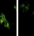 Researchers show that the small RNA 38A spurs cells to manufacture Var IV, a splice variant of a key neuronal protein, and potentially promote Alzheimer's disease. In this image, Var IV (green) is prevalent in cells that make extra 38A (left) but rare in control cells (right).