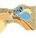 When sound waves reach the snail-shaped structure of the inner ear, sensory cells are activated. If the hair-like cilia of such cells are damaged by a mutation of the SMPX gene, they can no longer respond to acoustic stimuli.