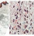 CXCL5 recruits immune cells into the skin.