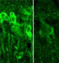 When exposed to large amounts of alcohol, neurons in the hippocampus produce steroids (shown in bright green, at left), which inhibit the formation of memory. Pictured at right, neurons in the same region of the brain that have not been exposed to alcohol.