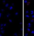 Injection of an AMPK activator (right) increased the number of apoptotic neurons (red) in the striatum of mice with Huntington’s disease (HD) compared to control cells (left). A new study in <i>The Journal of Cell Biology </i>describes how hyperactivation of AMPK promotes neurodegeneration in HD.