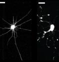 Left: A healthy neuron, with its dendrites and axon intact. Right: The damaged neuron has retracted its arms, breaking essential connections with its neighbors.