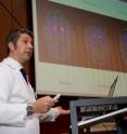 This is Dr. Alex Iranzo during the press meeting held at the IDIBAPS -- Hospital Clínic of Barcelona on July 29, 2011.