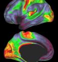 Scientists have found a way to use MRI scanning data to map myelin, a white sheath that covers some brain cell branches. Such maps, previously only available via dissection, help scientists determine precisely where they are at in the brain. Red and yellow indicate regions with high myelin levels; blue, purple and black areas have low myelin levels.