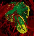 A first-of-a-kind look at the brain cancer, glioblastoma multiforme, was obtained using a new imaging technique at Case Western Reserve University School of Medicine. The main tumor is green, blood vessels feeding the tumor are red and migrating cells, yellow.
