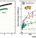 These graphs show the mechanical properties of human cortical bone as a function of age for (A) strength and (B) fracture-toughness.