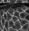 Time-lapse microscopy of a fruit fly epithelium in which a single cell is isolated from the remainder of the cell sheet using a single holographically-shaped laser pulse. The cell-to-be-isolated is marked with an asterisk in the first frame. Subsequent frames are at 6 s and 70 s after ablation.