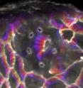 Time-lapse microscopy of a fruit fly epithelium in which a single cell is isolated from the remainder of the cell sheet using a single holographically-shaped laser pulse. Progression in time is color-coded from blue to red to white.