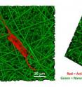 Bone-like cell growth on nanofibers: confocal microscope images detail the growth of a human bone marrow stromal cell (actin filaments in the cell "skeleton" are stained orange) on a nanofiber scaffold (green). The structure of thin fibers encourages stem cells to develop into the elongated, branched form characteristic of mature bone cells.