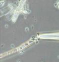 Microscope image of the glass capillary being used to capture a bacterial cell during micromanipulation.