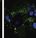 A new study in the <i>Journal of Cell Biology</i> suggests that differential expression of GAPDH and NDPK, two key metabolic enzymes, may explain why some people are more susceptible to liver damage.Compared to control cells (left), liver cells lacking GAPDH (right) show increased levels of reactive oxygen species (green) after treatment with the liver-damaging drug DDC.