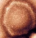 This is the Hendra virus.