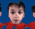 The MU researchers used a camera system that simultaneously captured four images to create a 3-D model of each child's head.