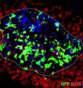 These are autoaggressive B-cells (green) in a lymph node close to the brain. The activation of the B-cells takes place in the germinal centre (blue) of the lymph node. The activated cells produce antibodies against the myelin layer in the brain and thus contribute to the formation of inflammatory reactions.