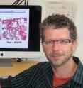 This is Thomas Weimbs with images of mouse polycystic kidney sections.