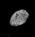 This is an X-ray CT scan of the underside of the prehistoric mite