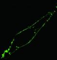 Fluorescence confocal image of a single living HeLa cell shows that via nanoendoscopy a quantum dot cluster (red dot) has been delivered to the cytoplasm within the membrane (green) of the cell.