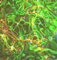 This is a network of neurons (in red) and glia cells (in green) grown in a petri dish. Blue dots are the cells' nuclei.