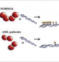 In this artist's conception, the four-protein complex called DNMT3A is shown in its normal configuration (top left). The complex reads or "tags" the cell's DNA. In the upper right side of the image, several of these tags are shown on top of the double helix of DNA. The tags control which genes in a cell get turned on and off. In the bottom left image, the complex of four proteins is disrupted. This disruption is caused by the mutation found in patients with acute myeloid leukemia. In the right side of the bottom image, the protein leaves only one tag on the DNA and then moves on.