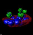 Scripps Research Institute biophysicist Peter Kuhn and colleagues have captured images of tumor cells circulating in the blood stream, such as this cluster of lung tumor cells (in red-blue) shown interacting with normal blood cells (green-blue) recovered from a blood sample of patient with lung cancer. Scripps Research Institute biophysicist Peter Kuhn and colleagues have captured images of tumor cells circulating in the blood stream, such as this cluster of lung tumor cells (in red-blue) shown interacting with normal blood cells (green-blue) recovered from a blood sample of patient with lung cancer.