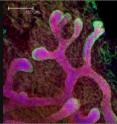 The Salk researchers found similarities in genetic activity of breast cancers and mammary stem cells found in developing mouse embryos (pictured here against a background of fat tissue). Their findings offer clues to developing personalized therapies for cancers. The Salk researchers found similarities in genetic activity of breast cancers and mammary stem cells found in developing mouse embryos (pictured here against a background of fat tissue). Their findings offer clues to developing personalized therapies for cancers.