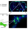 Above left are the survival curves for "Alzheimer flies" treated (dashed line) and those not treated with curcumin. The flies that were administered curcumin lived longer and were more active. The scientists identified an accelerated formation of amyloid plaque in the treated flies, which seemed to protect the nerve cells. 

On the right we see microscopic images of neurons (blue) and plaque (green) in the fruit fly's brain. The study strengthens the hypothesis that a curcumin-based drug can contribute to toxic fibrils being encapsulated (bottom left of the figure).