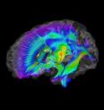 This is an image of white matter pathways extracted from diffusion tensor imaging data for infants at-risk for autism. Warmer colors represent higher fractional anisotropy.