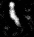 An optimized negative-staining EM of CETP shows the protein's banana shape.