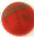 These are colonies of <i>S. tigurinus</i> on sheep blood agar.