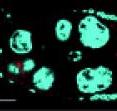 Oskar RNA (red) is transported to the posterior pole in a normal fruit fly egg cell (left), but not in an oocyte with a mutated SOLE tag (right).