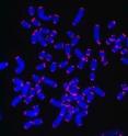 Proper processing of the RNA component of telomerase, the enzyme that maintains the ends of chromosomes (shown in red), is essential for the formation of active telomerase complexes.