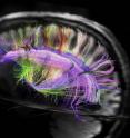 Curvature in this DSI image of a whole human brain turns out to be folding of 2-D sheets of parallel neuronal fibers that cross paths at right angles. This picture came from the new Connectom scanner.